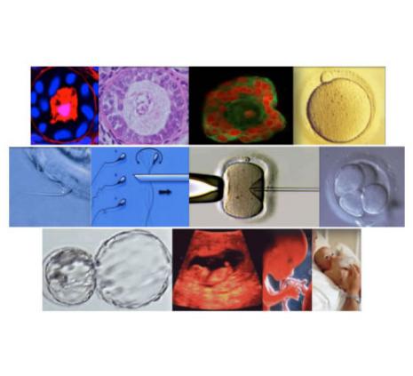 Advanced course in Human oocytes, embryo and ovarian tissue vitrification